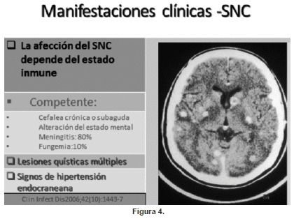 Manifestaciones clínicas SNS