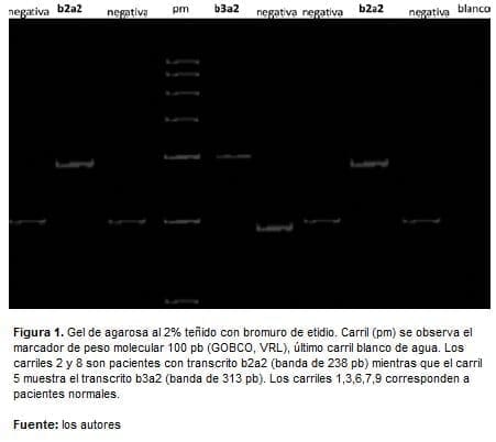 RNAm extraído de leucocitos RNAm extraído de leucocitos