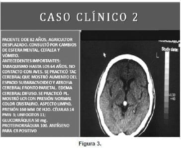 Tomografía Axial Computarizada Cerebral