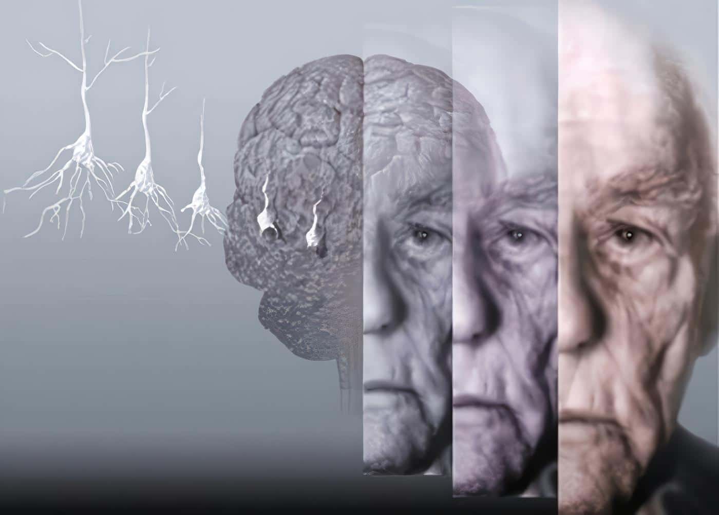 guía de alzheimer