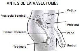 Organos de Reproducción Masculina, antes de la vasectomía Organos de Reproducción Masculina, antes de la vasectomía