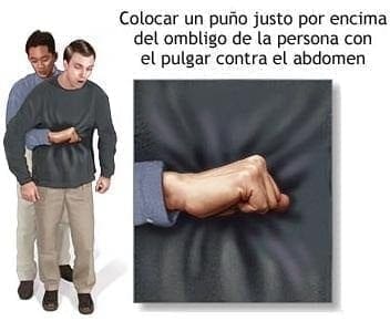 Procedimiento en Ahogamiento Procedimiento en Ahogamiento