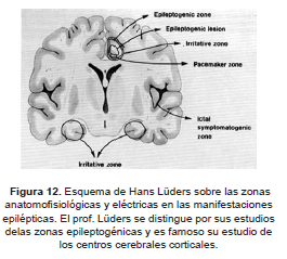 Esquema de Hans Lüders Esquema de Hans Lüders