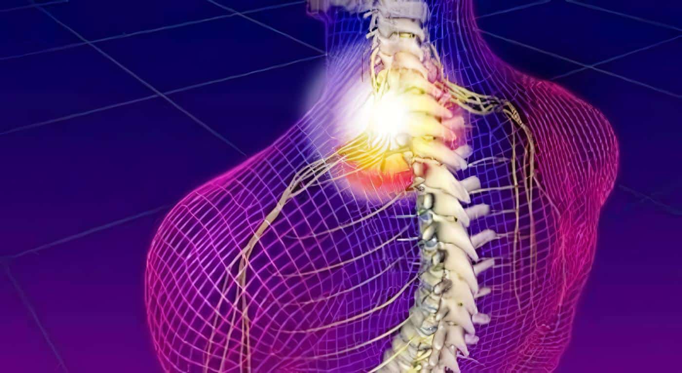 Trauma Raquimedular