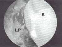 Una lámina de Gelfilm