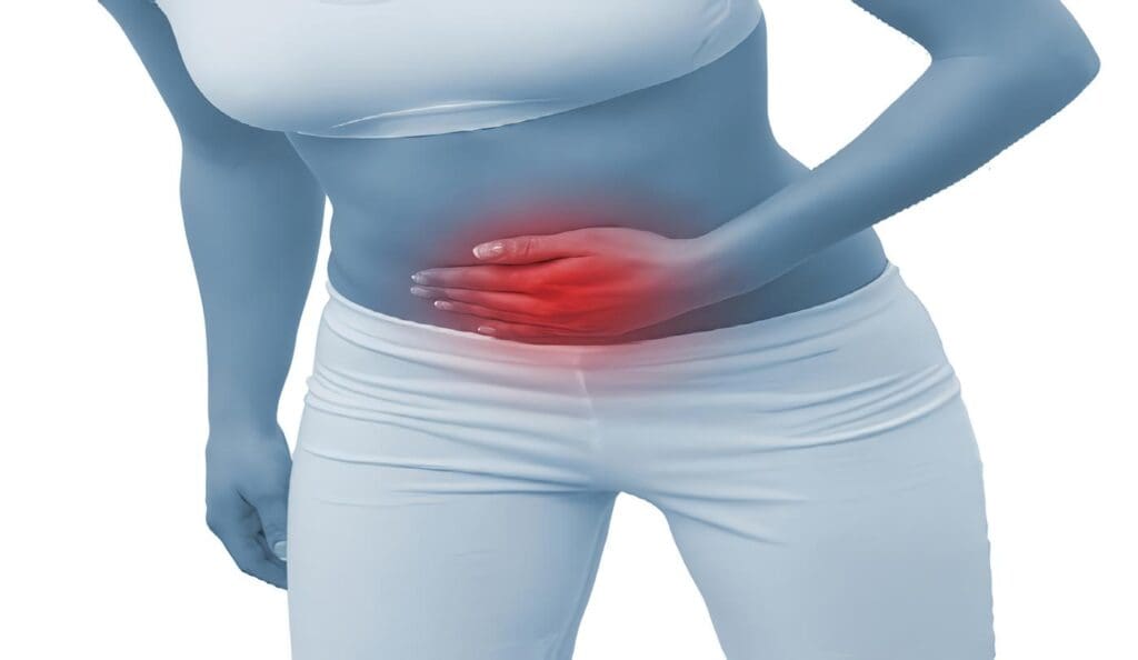 Cáncer de Apéndice
