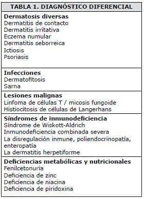 Dermatitis Atópica, Diagnóstico diferencial