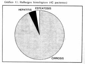 Hallazgos, Enfermedad Hepática Alcohólica Hallazgos, Enfermedad Hepática Alcohólica