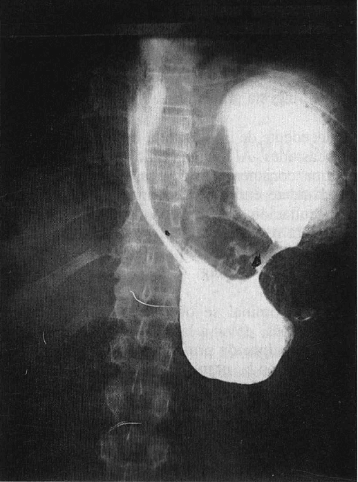 Serie gastroduodenal Serie gastroduodenal