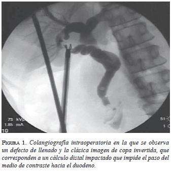 figura1-colangiografia