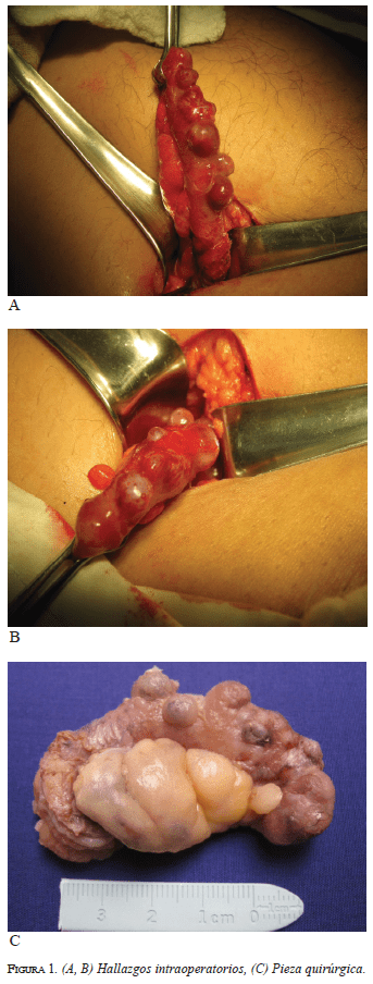 figura1Hallazgos-intraoperatorios