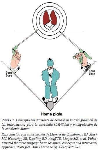 figura3-diamante-de-beisbol