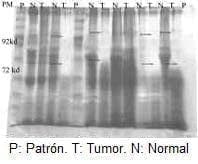 Tejido normal y tumoral Tejido normal y tumoral
