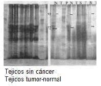 Tejidos sin cáncer Tejidos sin cáncer