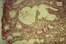 Mucosa gástrica con actividad, HE100X. Mucosa gástrica con actividad, HE100X.