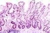 Células con citoplasma granular eosinofílico o células de Paneth Células con citoplasma granular eosinofílico o células de Paneth