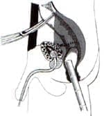 Prueba hidroneumática