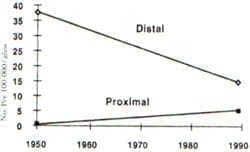 Incidencia por épocas de cáncer proximal y distal Incidencia por épocas de cáncer proximal y distal