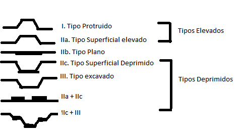 Clasificación macroscópica del cáncer gástrico Clasificación macroscópica del cáncer gástrico