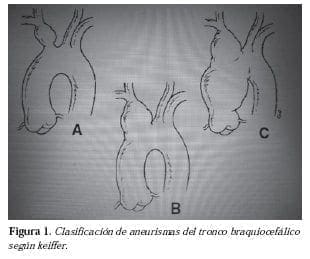 Figura 1. Clasificaci0n