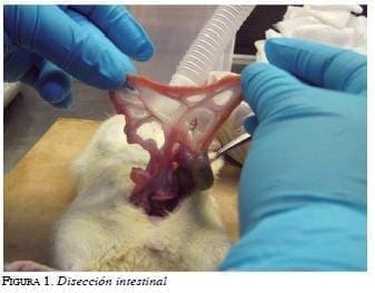 Diseccion intestinal