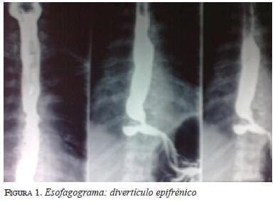 figura1esofagograma