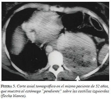 Corte Axial tomografico figura5-corte-axial