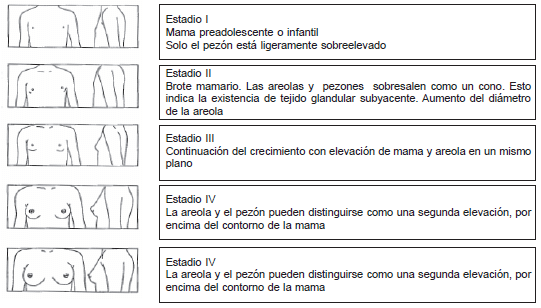 Desarrollo mamario Tanner en niñas Desarrollo mamario Tanner en niñas