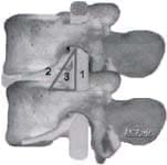Esquema del triangulo de seguridad Esquema del triangulo de seguridad