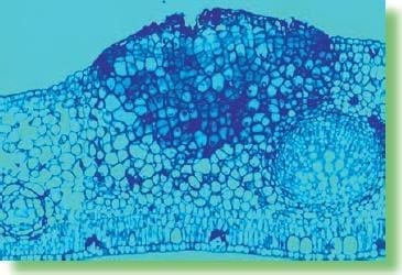 Hiperplasia de los tejidos a causa del cáncer de los cítricos Hiperplasia de los tejidos a causa del cáncer de los cítricos