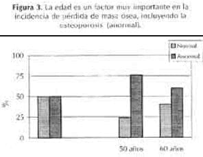 La edad en la osteoporosis 