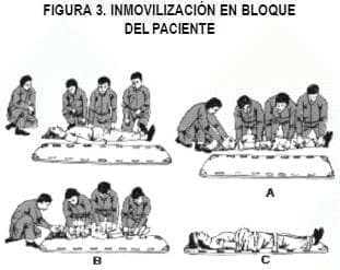 Inmovilización en bloque del paciente Inmovilización en bloque del paciente