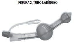 Tubo laríngeo Tubo laríngeo