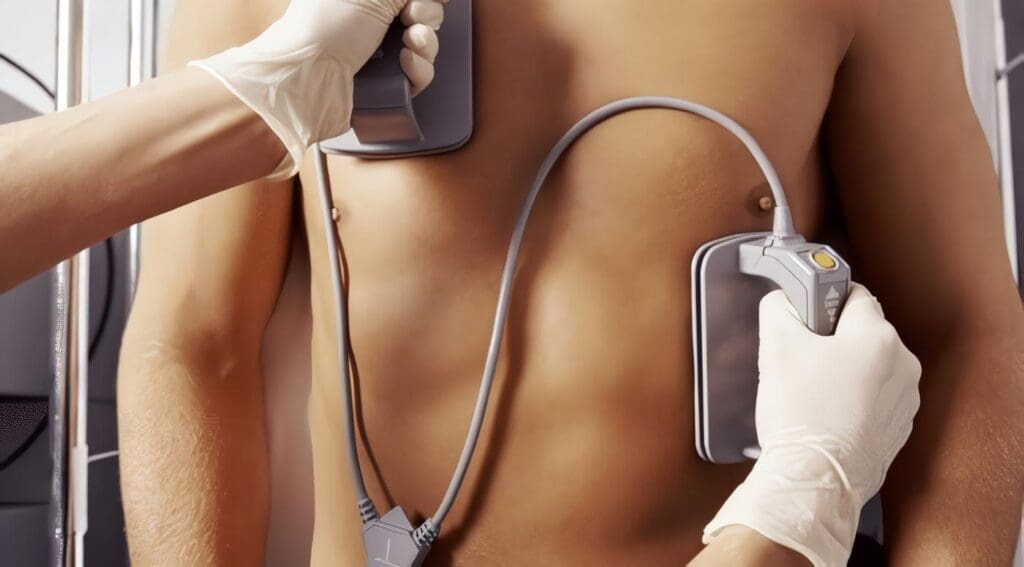 paro cardiaco atencion prehospitalaria