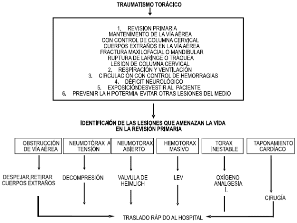 Traumatismo torácico - Identificación de lesiones Traumatismo torácico - Identificación de lesiones