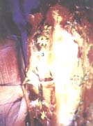 Rama de la metafisis proximal de F1 Rama de la metafisis proximal de F1