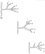 A AG. Arteria digital A AG. Arteria digital
