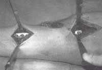 Fijación con tornillos Fijación con tornillos