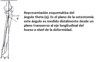 Representación esquemática del ángulo theta Representación esquemática del ángulo theta