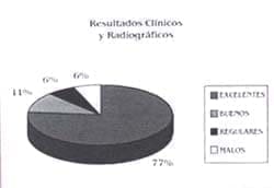 Resultados Clínicos y radiográficos displasia de Cadera