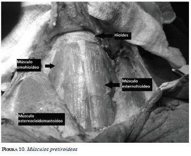 Músculos pretiroideos