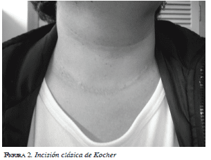 Incisión clásica de Kocher Incisión clásica de Kocher