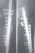 Fractura de fémur resultados con placa e injertos óseos Fractura de fémur resultados con placa e injertos óseos