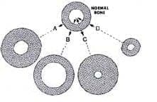 Clasificación dinámica Enfermedad de Paget Clasificación dinámica Enfermedad de Paget