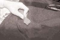 Prueba de Allen técnica Prueba de Allen técnica