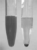 Hematuria Loin Pain Hematuria Loin Pain