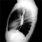 Experiencia clínica en ALTE Experiencia clínica en ALTE