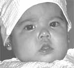 Síntomas en ALTE Síntomas en ALTE