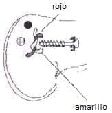 Radiografía de Merchant articulación patelofemoral Radiografía de Merchant articulación patelofemoral