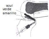 Músculos extensores y flexores - ligamento cruzado Posterior Músculos extensores y flexores - ligamento cruzado Posterior